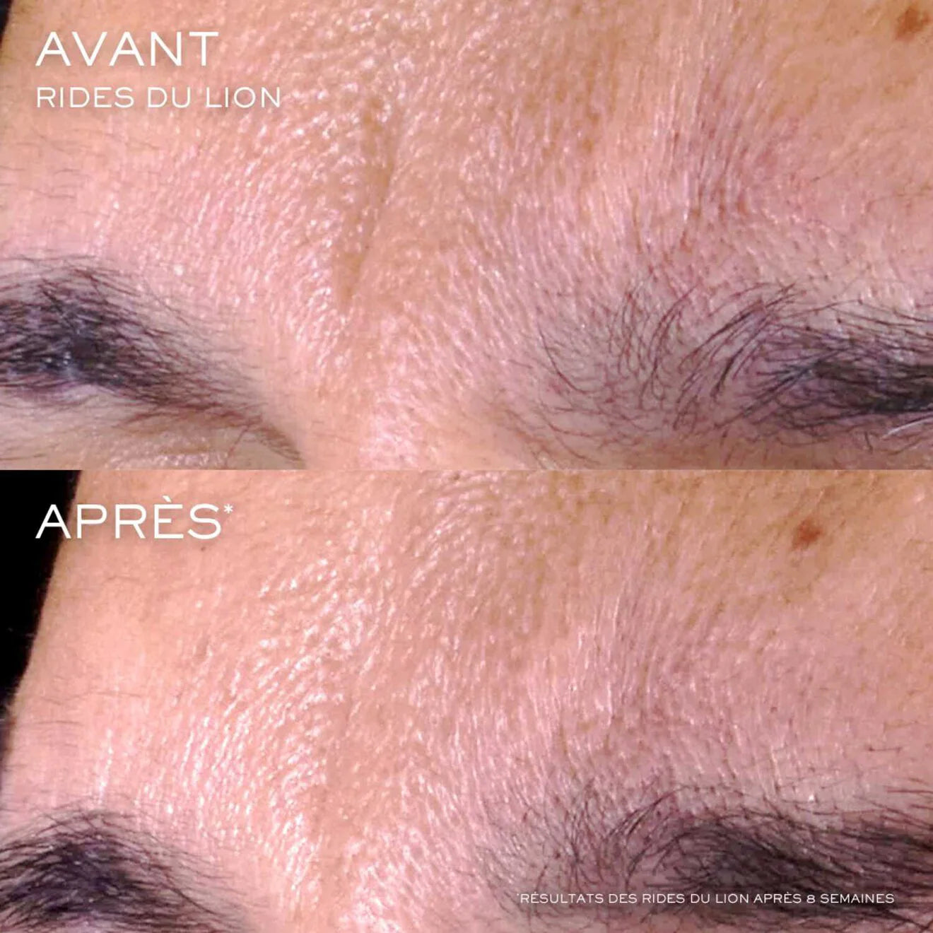 Rénergie C.R.X. Triple Serum Retinol