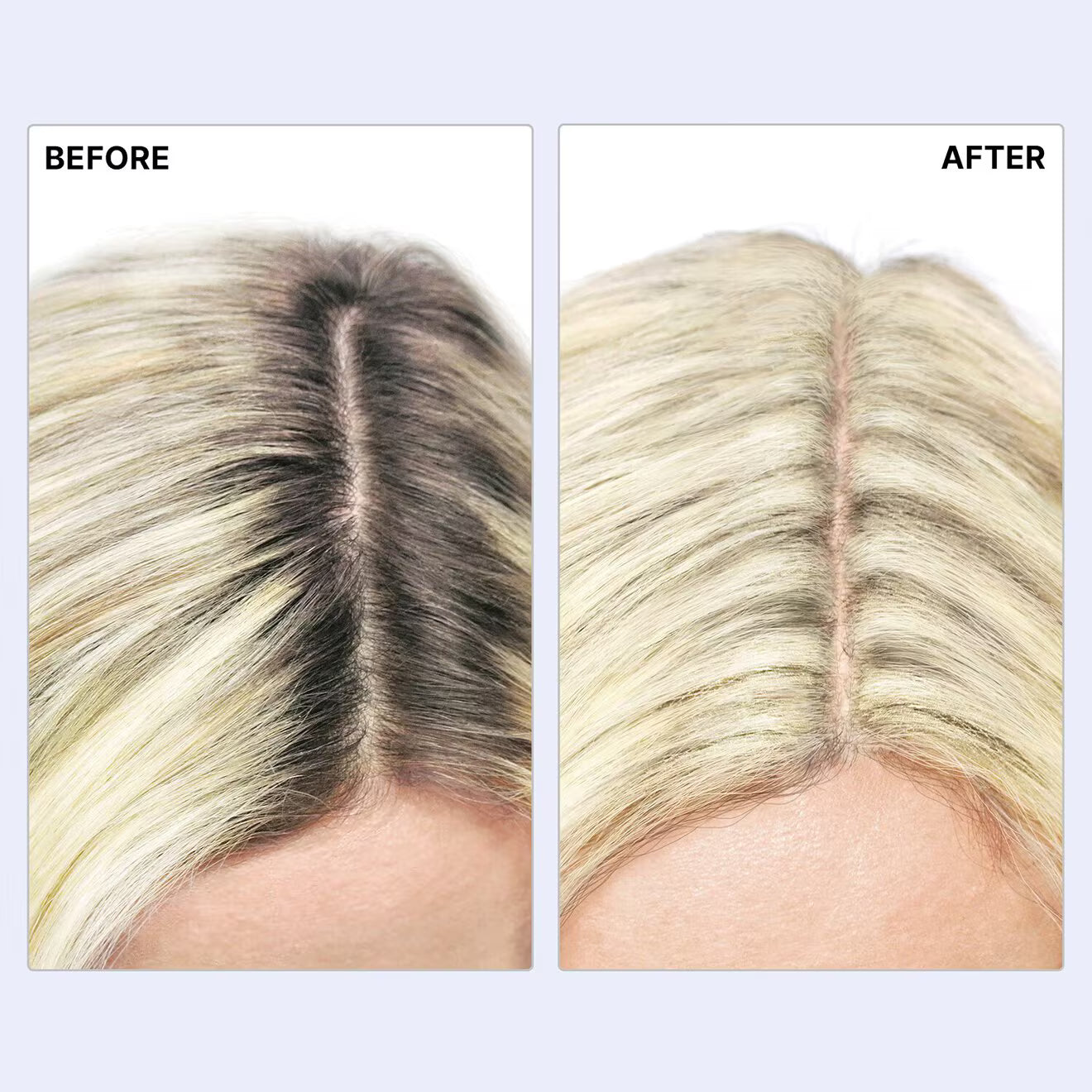 Root Cover Up