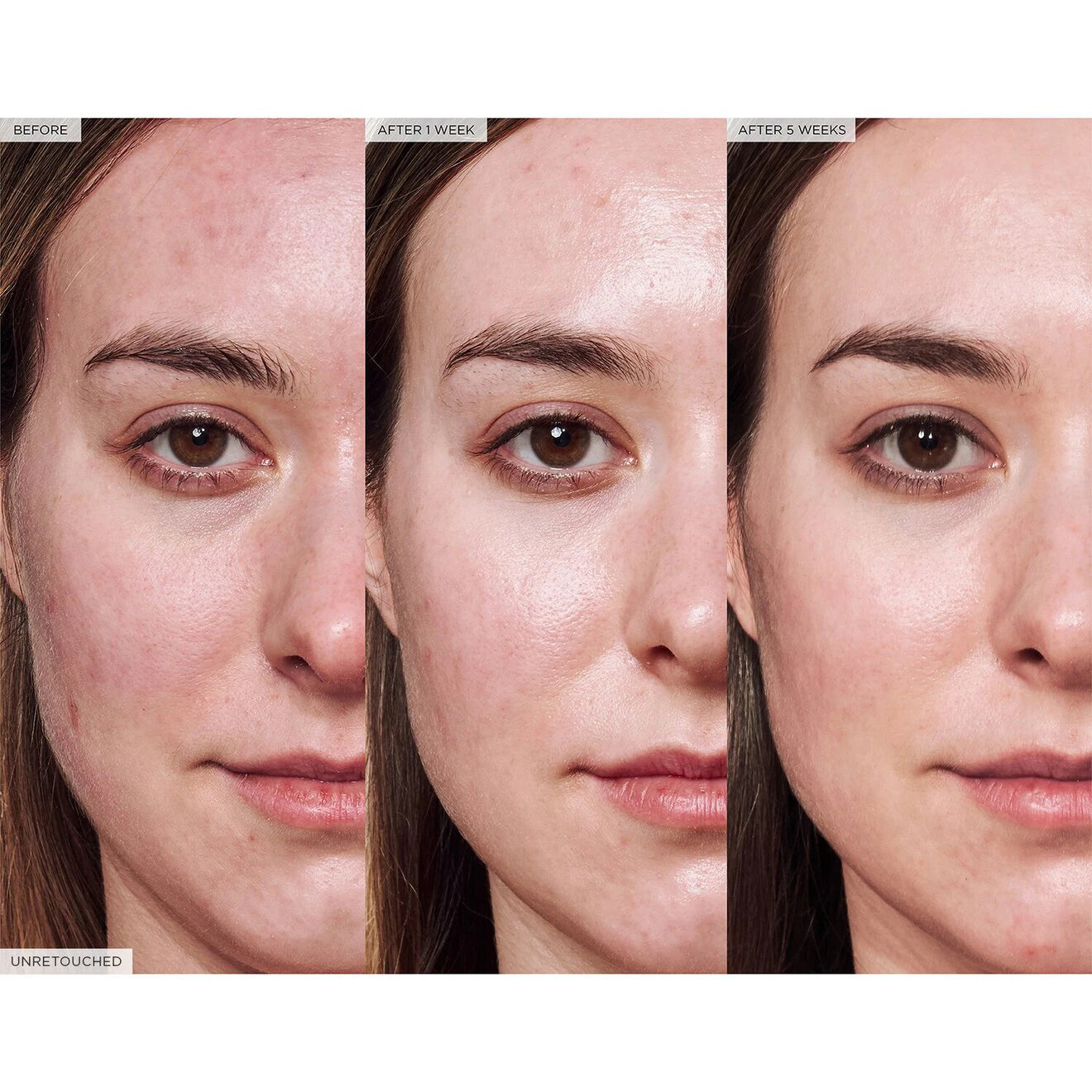 Avocado Ceramide Recovery Serum