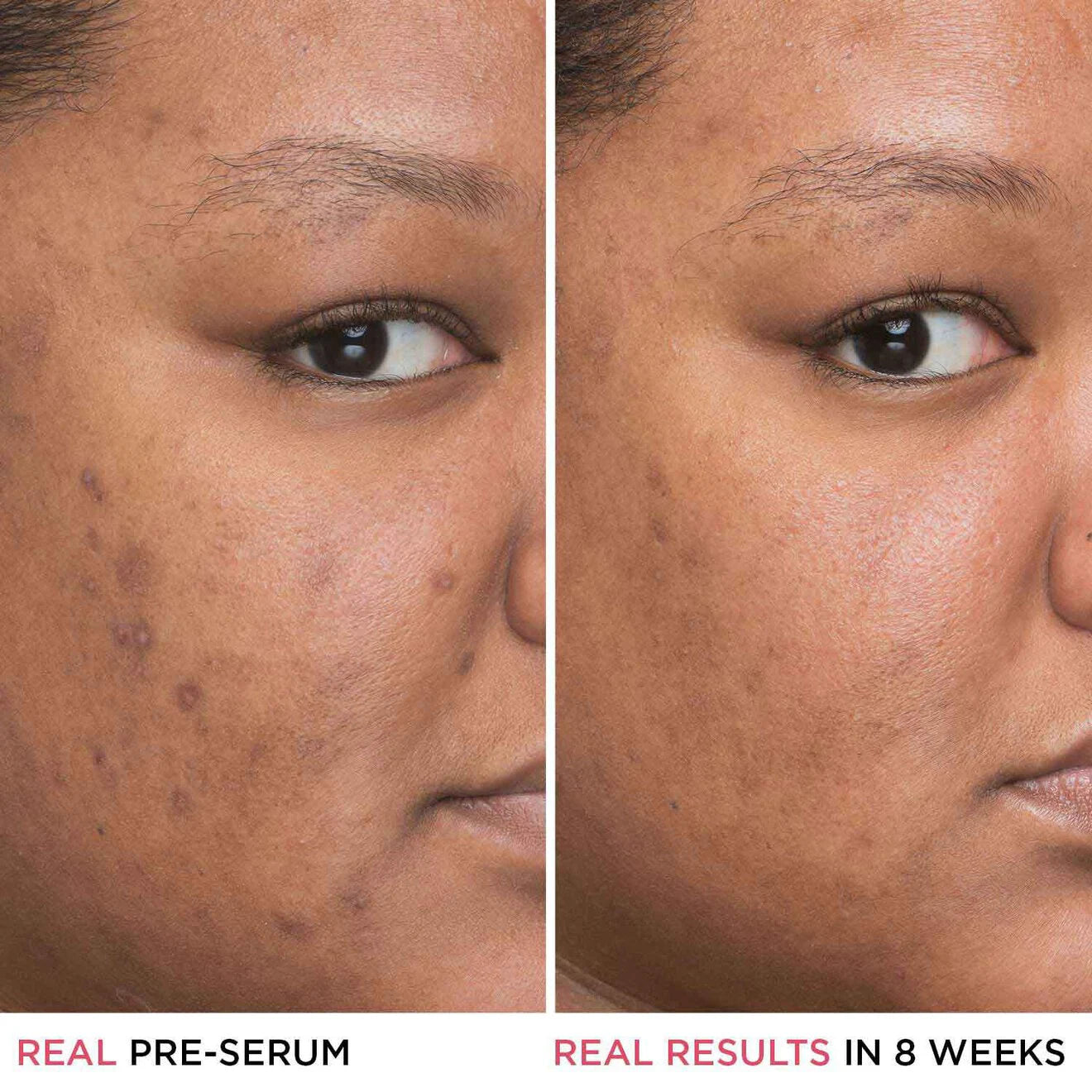 BYE BYE DARK SPOTS SERUM