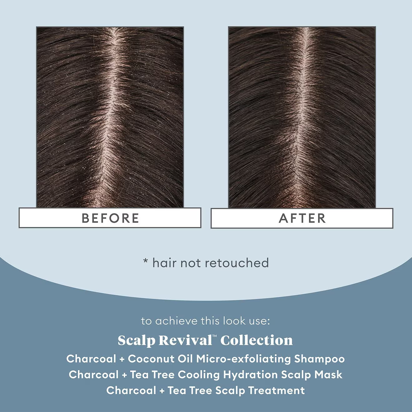 Scalp Revival™ Charcoal + Coconut Oil Micro-exfoliating Scalp Shampoo