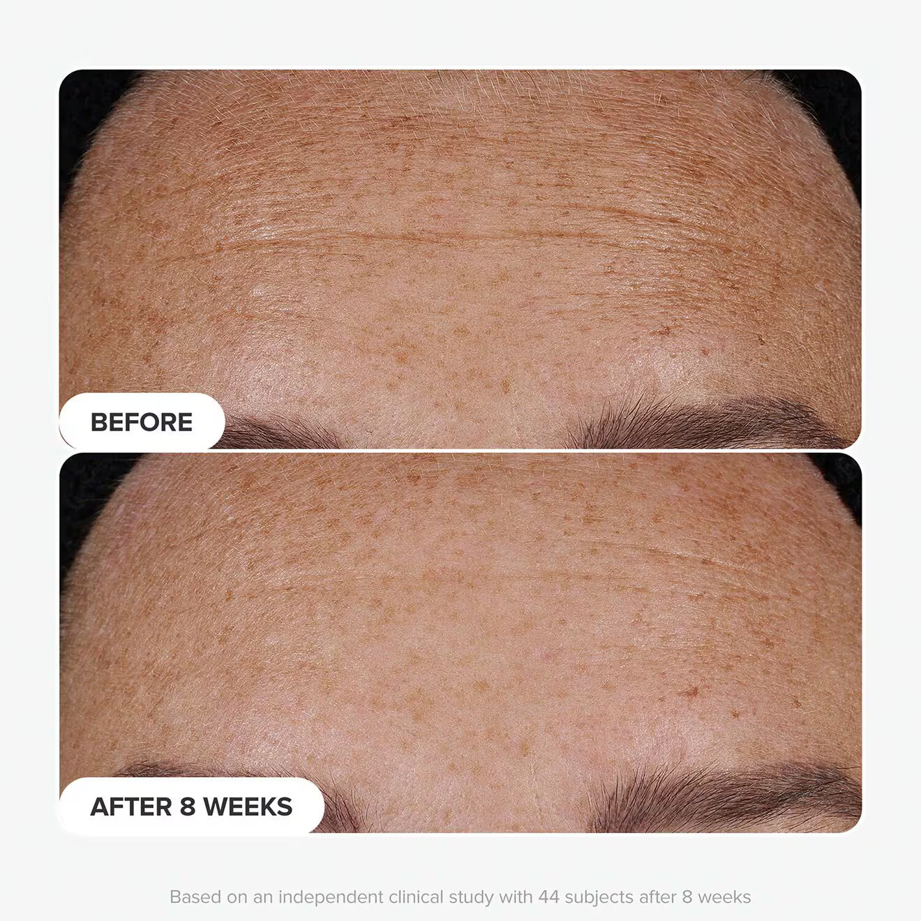 Clinical Pro Retinaldehyde Dual-Retinoid Treatment