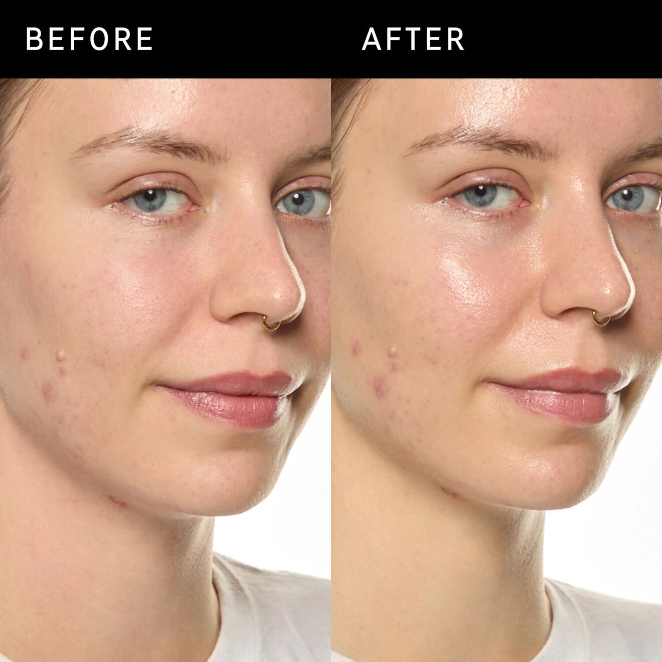 Ectoin Hydro-Barrier Serum