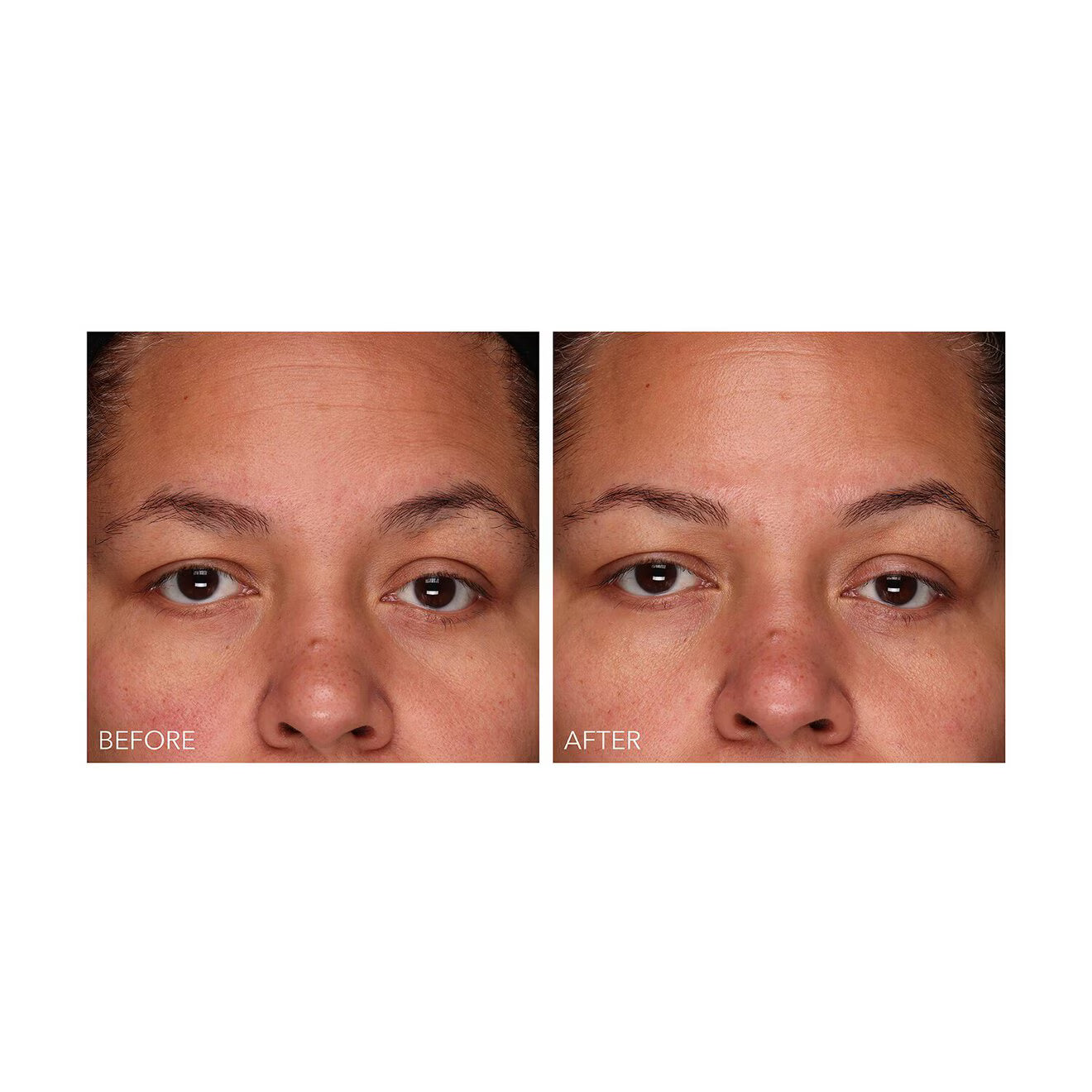 DermInfusions™ - Fill + Repair Serum