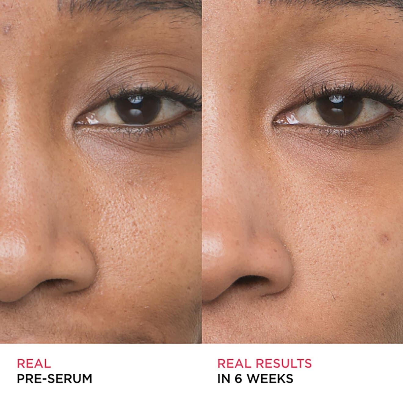 BYE BYE PORES SERUM