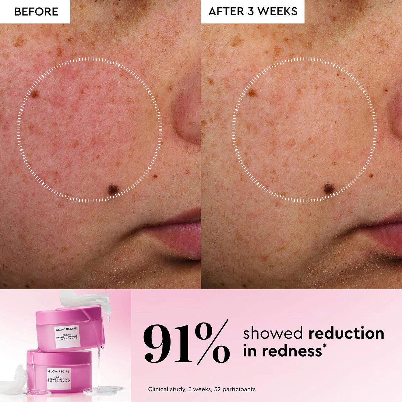 PDRN+ Repair + Soothe Korean Toner Pads for Skin Barrier Repair