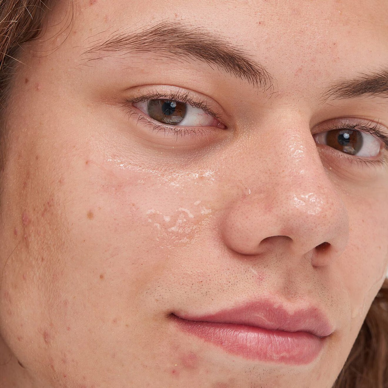 Beta Hydroxy Acid Serum