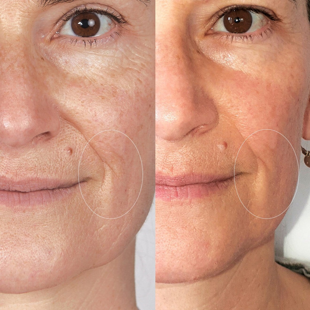 Resveratrol - Lift Instant Firming Serum