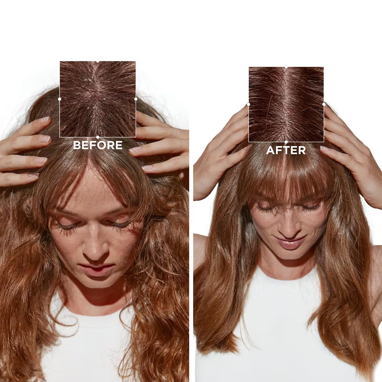 Symbiose Moisturizing Anti-Dandruff Shampoo