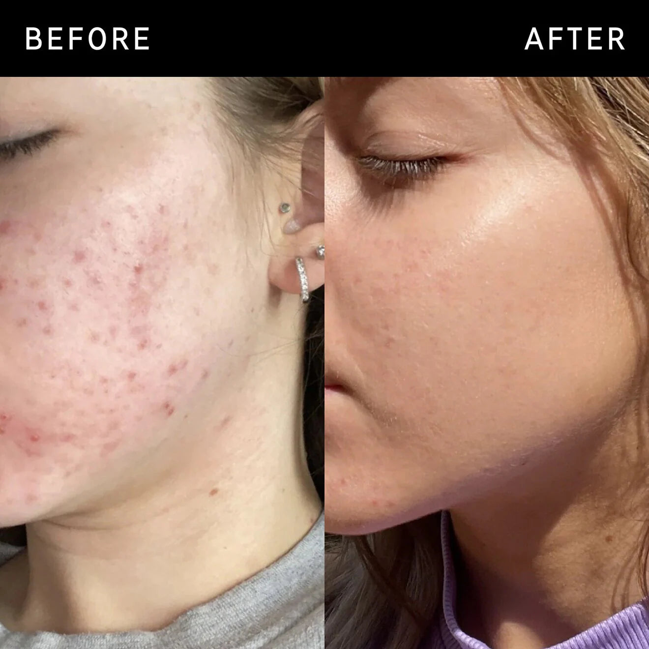Niacinamide Serum