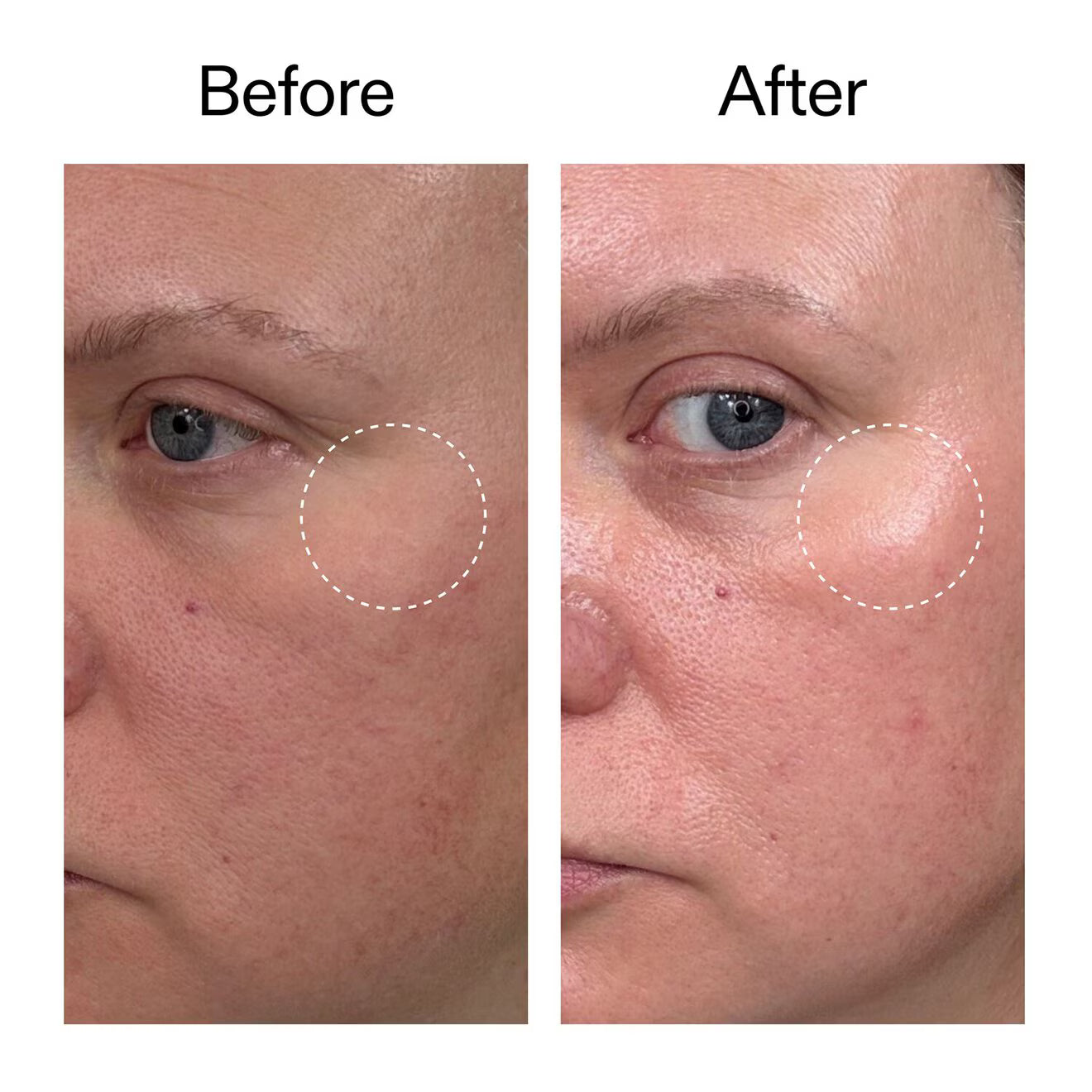 Advanced Retinal Serum