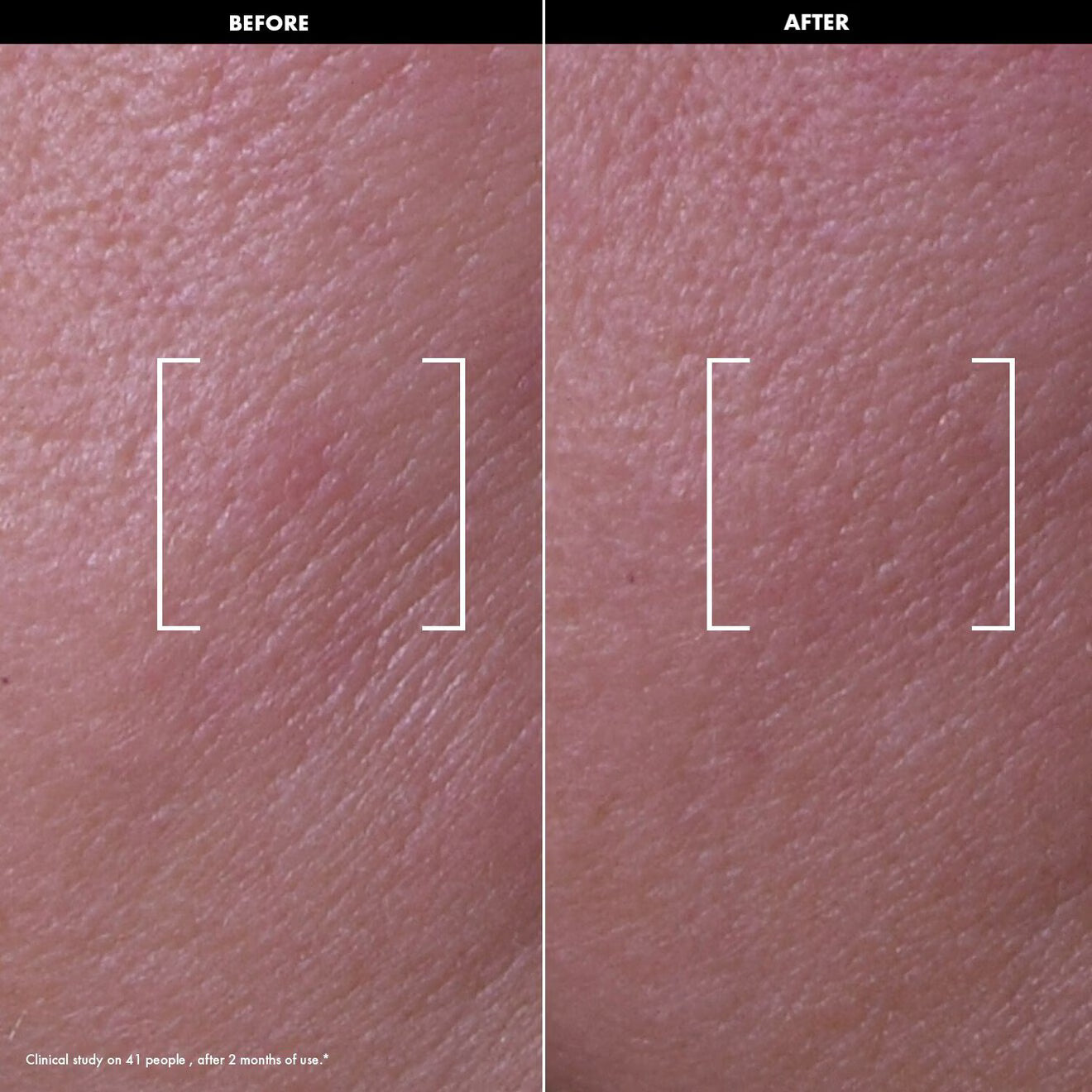 Recovery Firming Night Oil – Regenerates + Boosts Firmness
