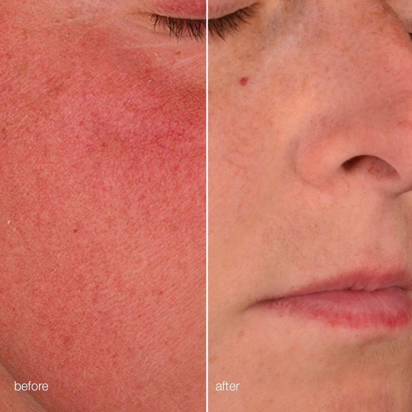Retinol Clearing Oil
