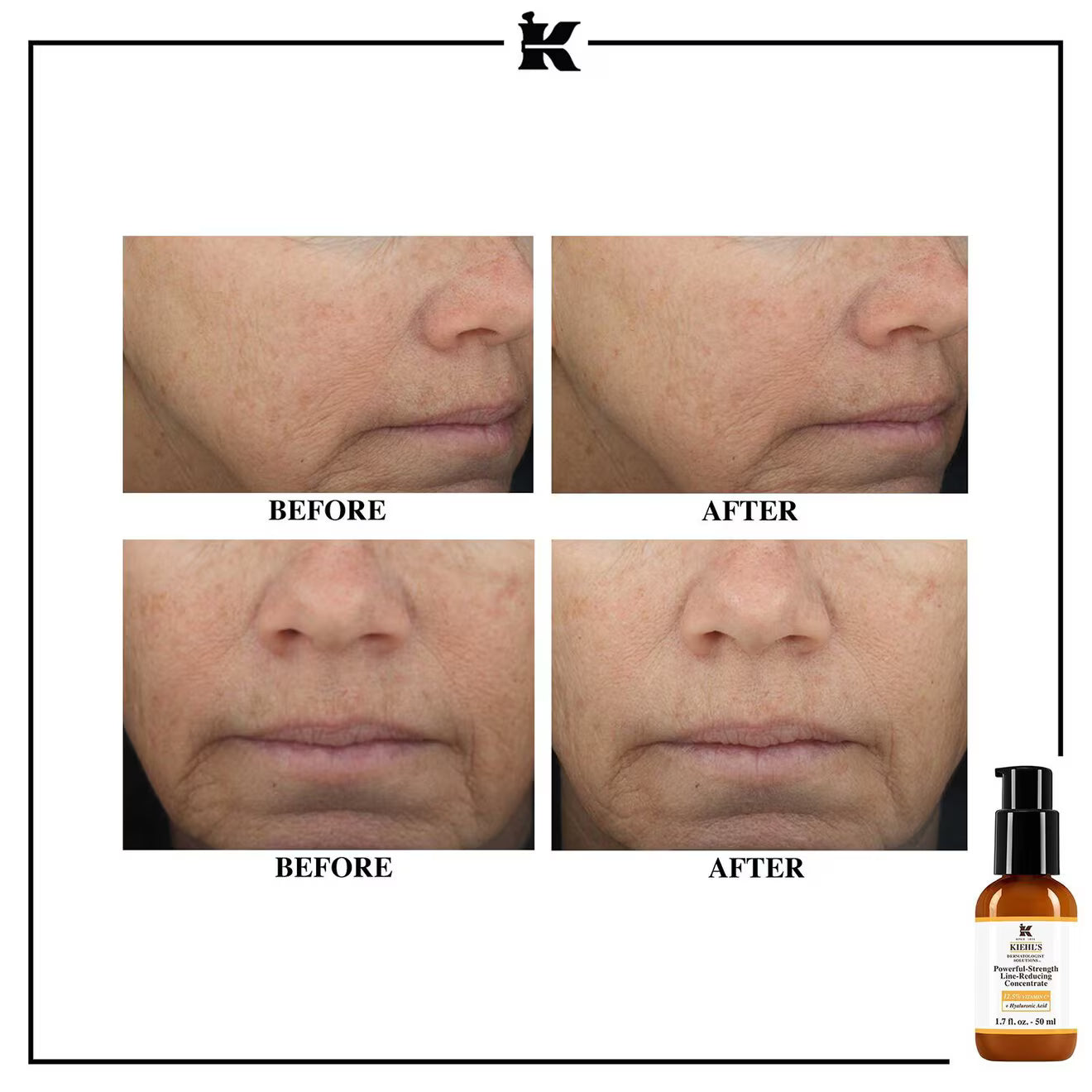 Powerful-Strength Line-Reducing Vitamin C Serum
