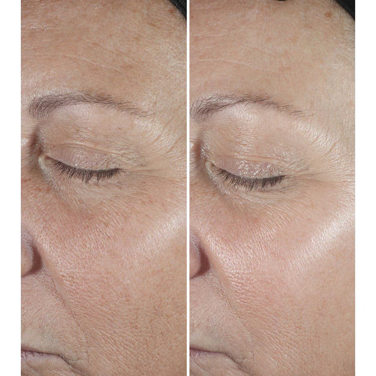 Smart Clinical Repair Wrinkle Correcting Serum