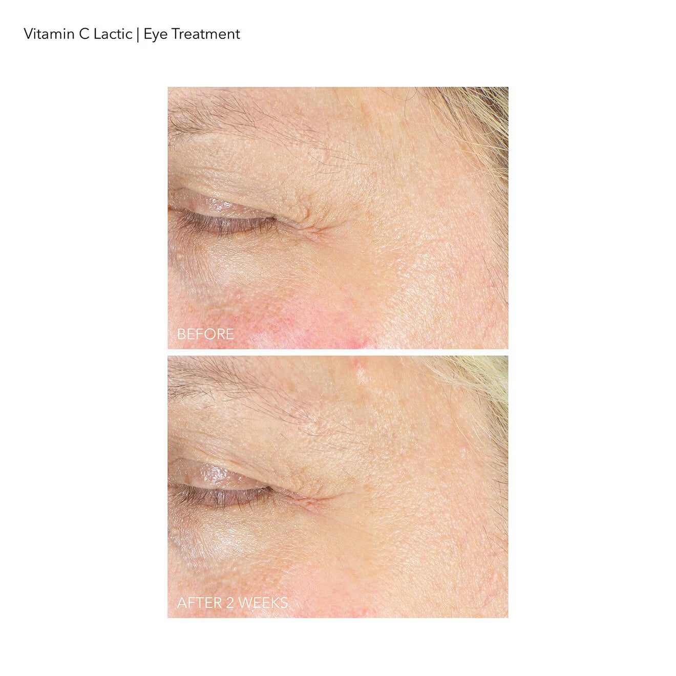 Vitamin C + Lactic Firm & Bright Eye Treatment