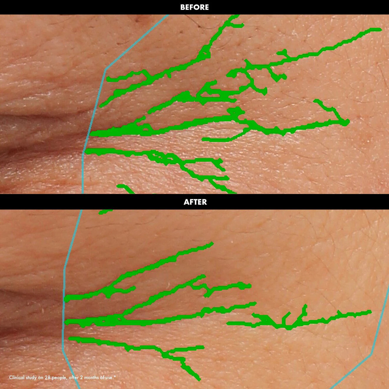 Smoothing & Firming Eye Cream – Smooths + Firms