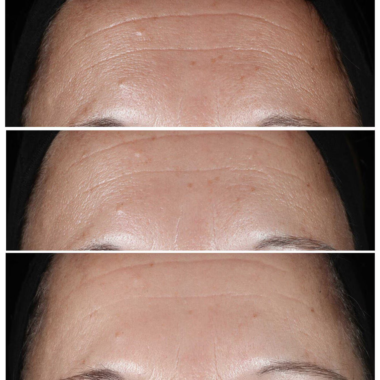 Smart Clinical Repair Wrinkle Correcting Serum
