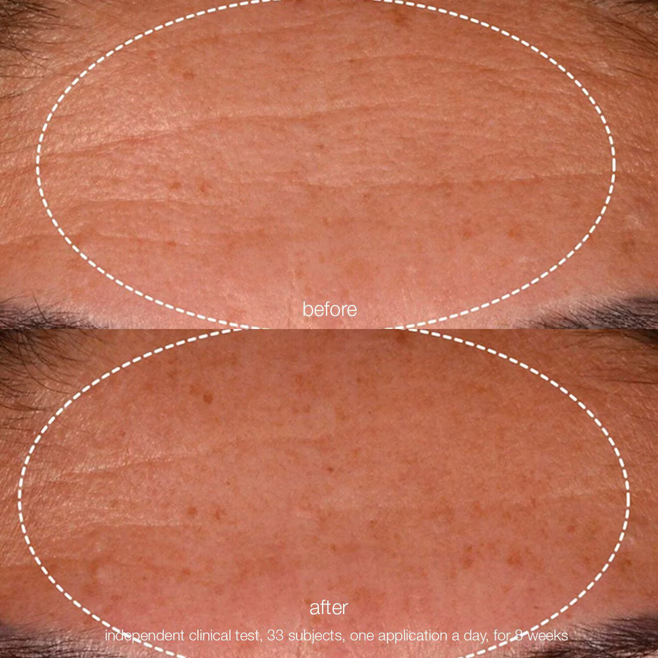 Dynamic Skin Recovery Spf50 Moisturiser