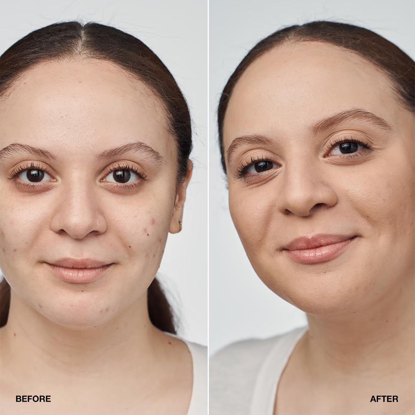 Even Better Clinical™ Serum Foundation SPF20