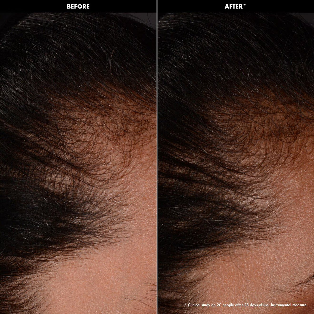 Density Booster - Scalp Serum