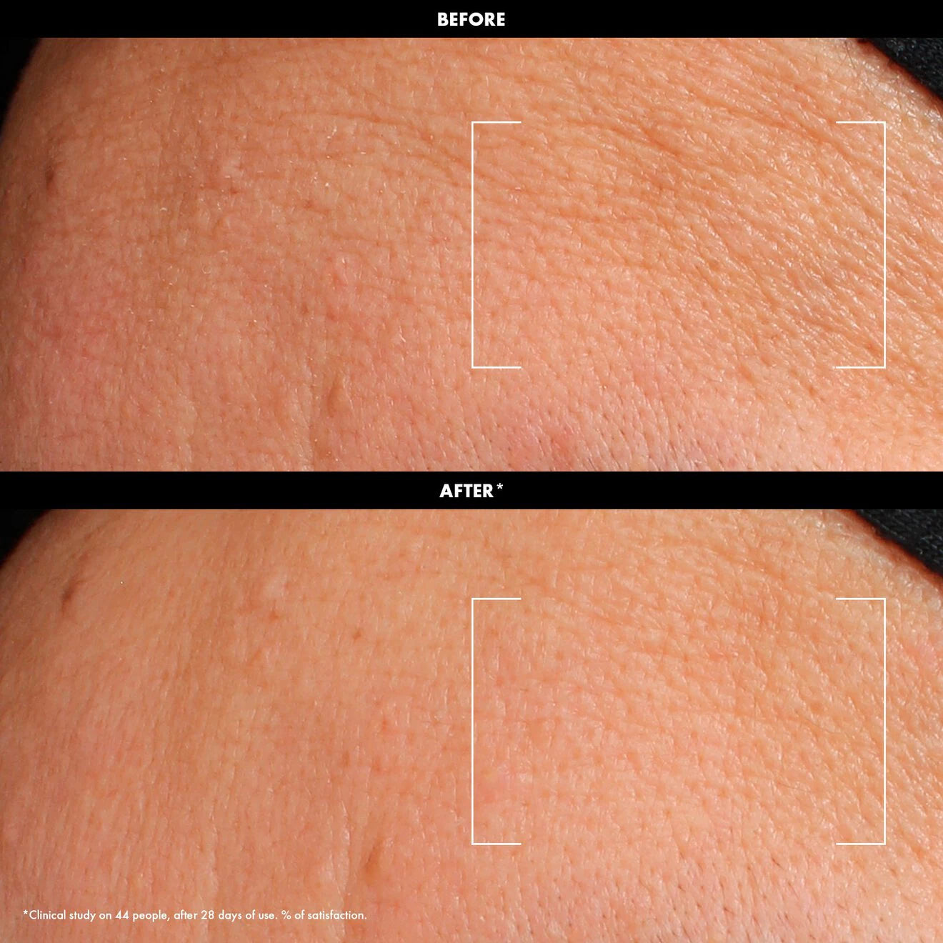 Hydrate – Satin Light Cream with Hyaluronic Acid