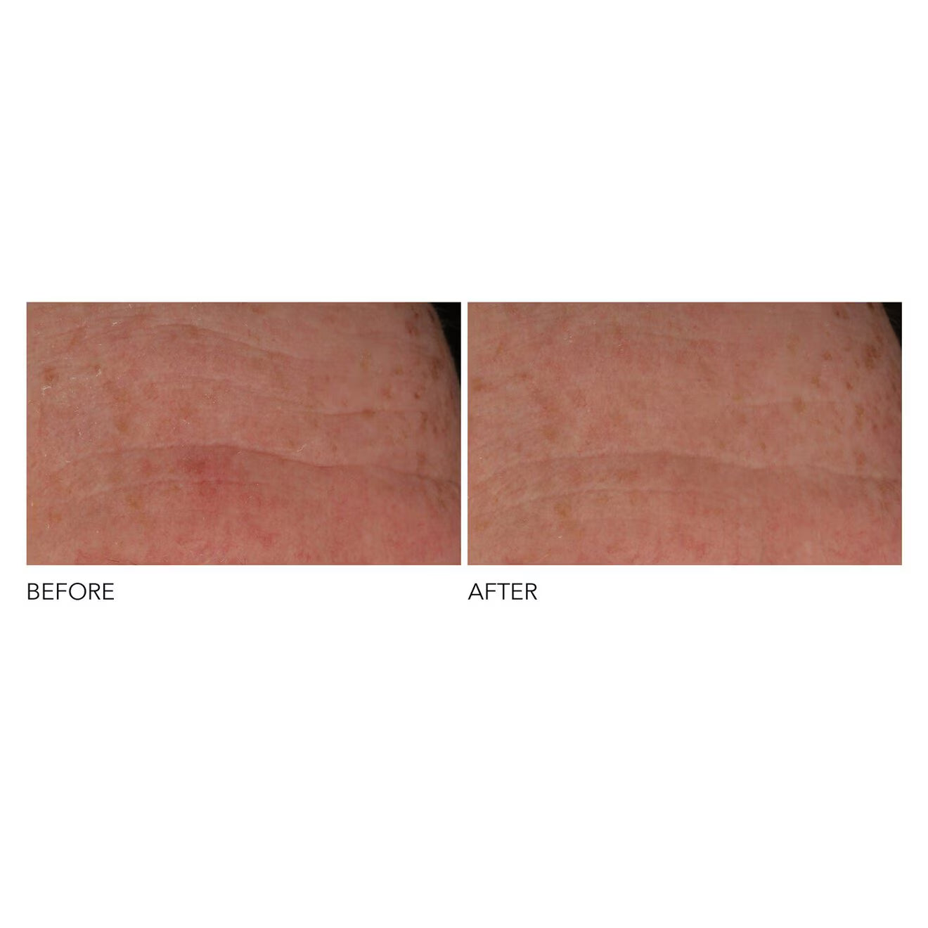 Advanced Retinol + Ferulic Overnight Wrinkle Treatment